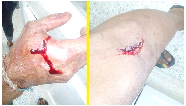 El adulto recibió herida de machete en una pierna y en una mano.