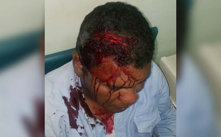 Con heridas en la cabeza llegó a una clínica de la ciudad para el respectivo procedimiento médico el contratista de Electricaribe. Con heridas en la cabeza llegó a una clínica de la ciudad para el respectivo procedimiento médico el contratista de Electricaribe.